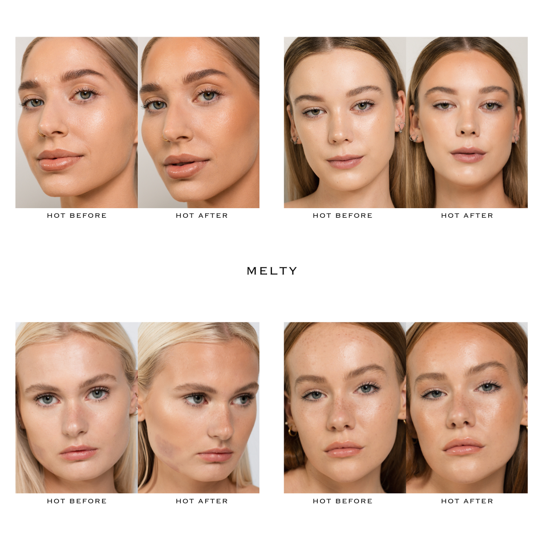 MELTY